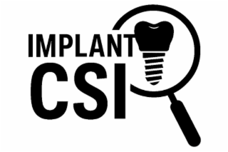 implant csi
