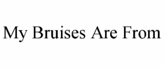 my bruises are from